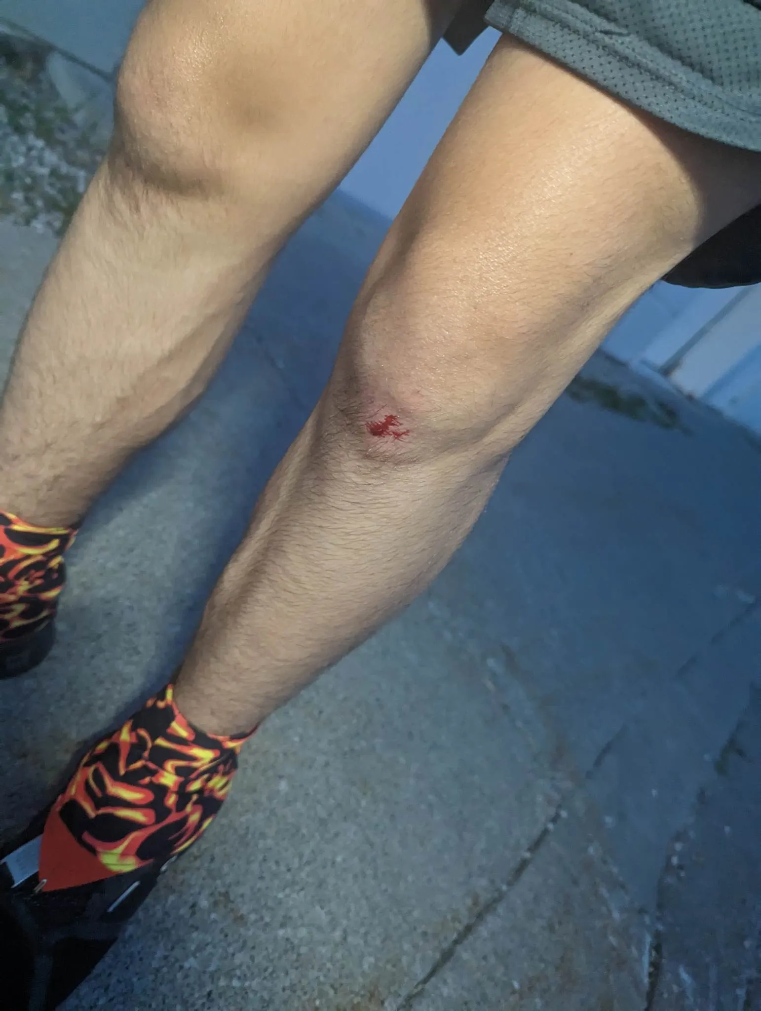 Photo from blog post 183