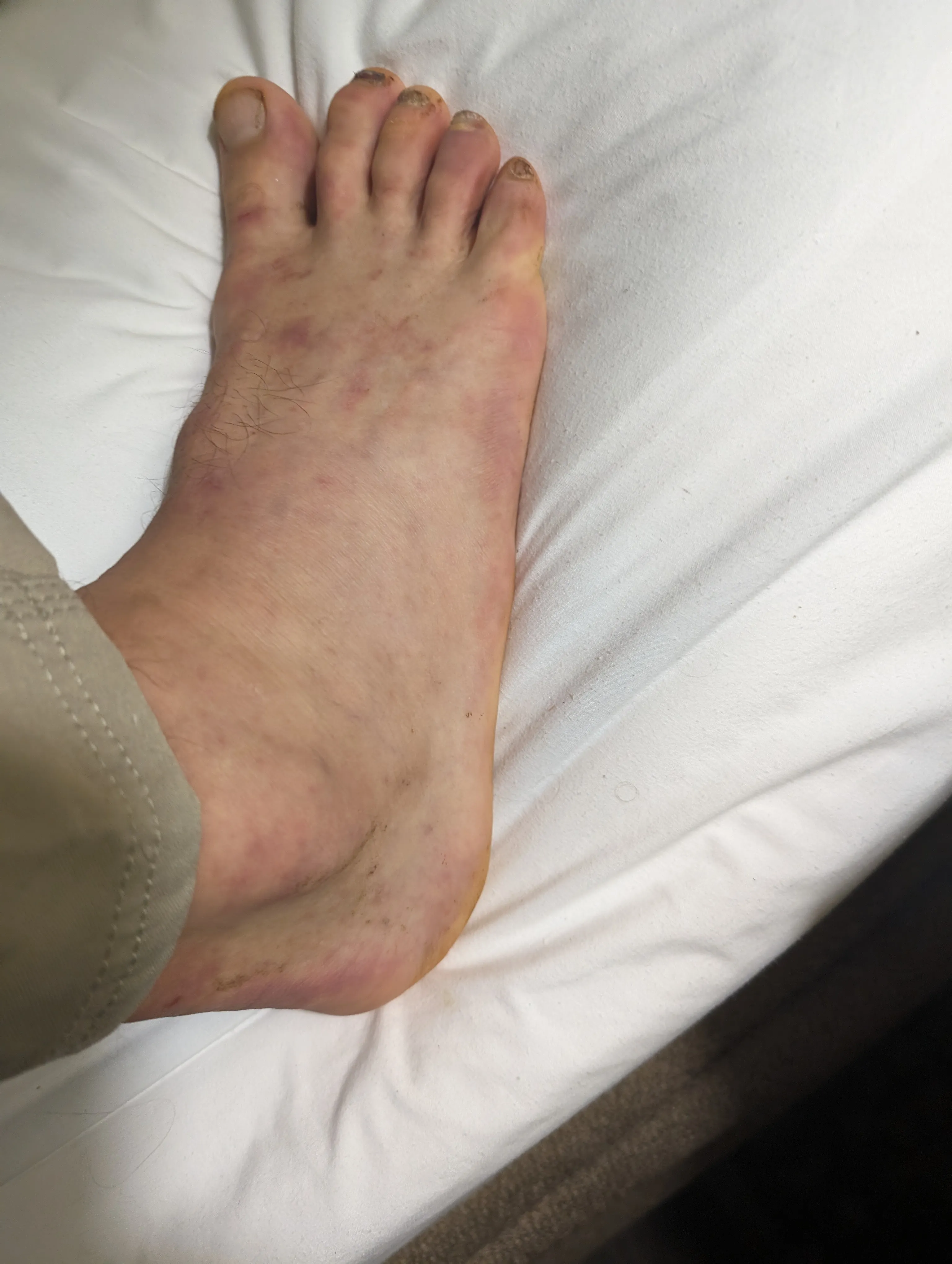 Photo from blog post 187