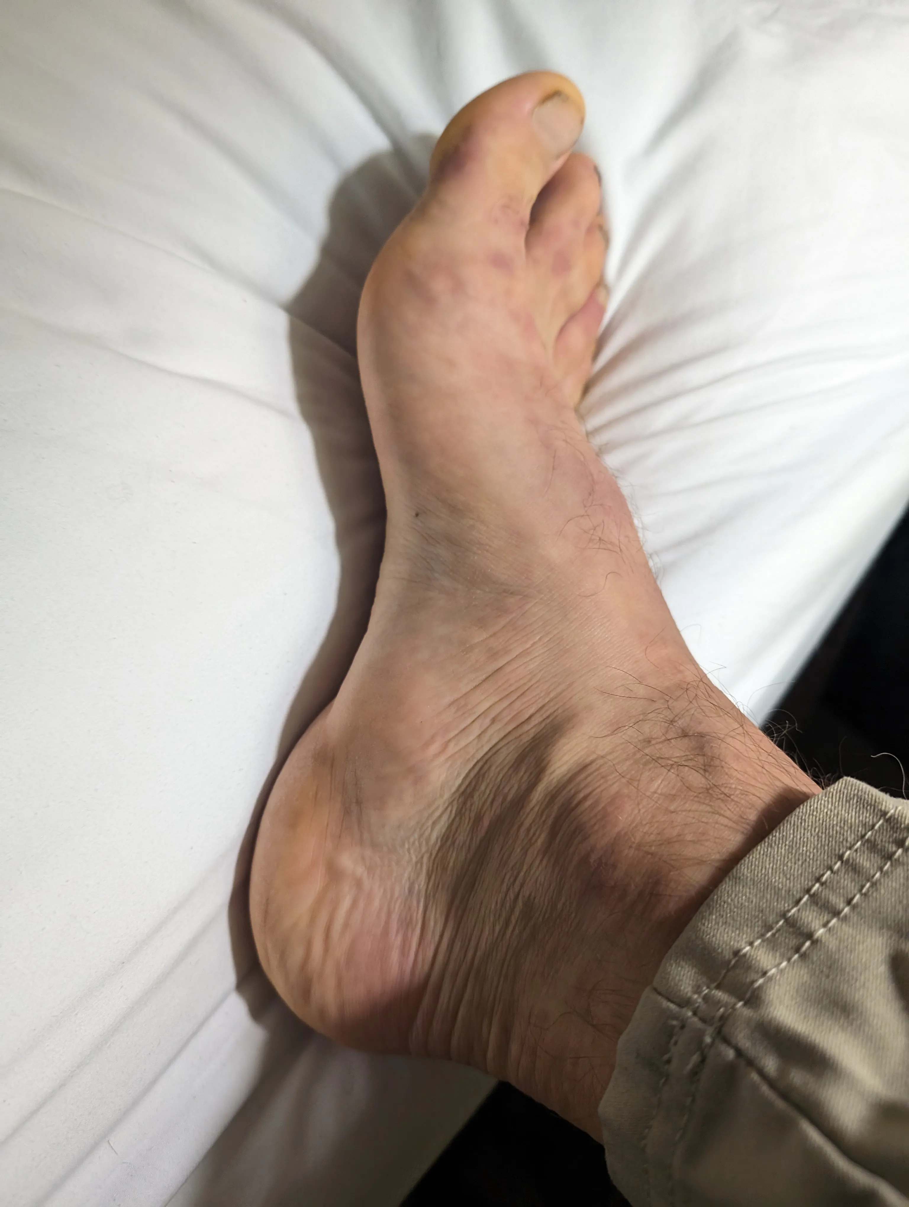 Photo from blog post 187