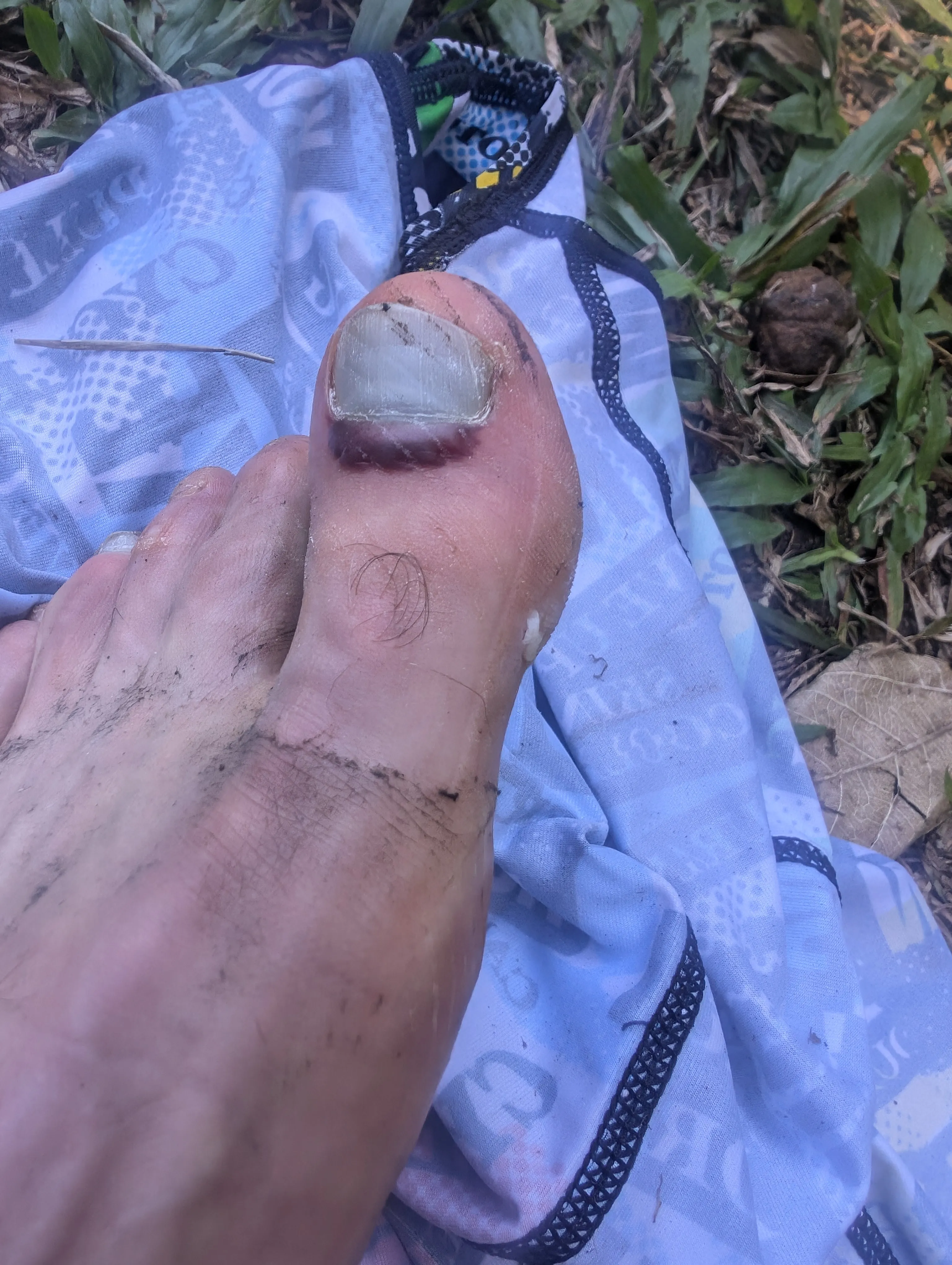 Photo from blog post 188